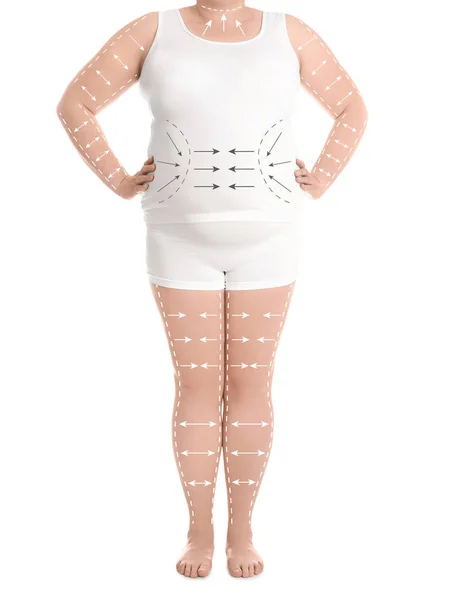 흰색 바탕에 속옷에 여자, 근접 촬영. 체중 감량 컨셉 — 스톡 사진