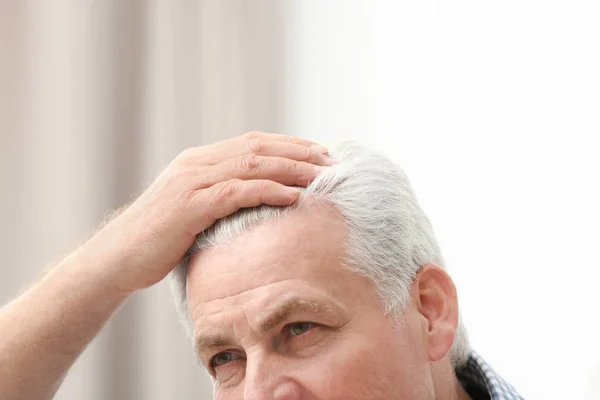 Homem sênior com problema de perda de cabelo dentro de casa, close-up — Fotografia de Stock