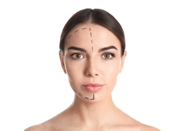 Νεαρή γυναίκα με σημάδια στο πρόσωπο για πλαστική χειρουργική επέμβαση σε λευκό φόντο — Φωτογραφία Αρχείου