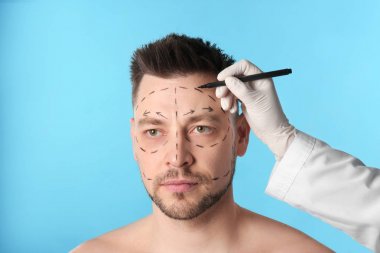 Doktor mavi arka plan karşı kozmetik cerrahi operasyon için adamın yüzüne işaretler çizim