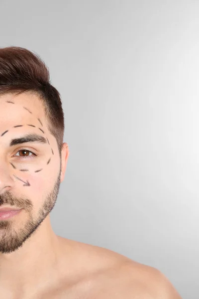Ung man med märken på ansiktet för kosmetisk kirurgi operation mot grå bakgrund, utrymme för text — Stockfoto
