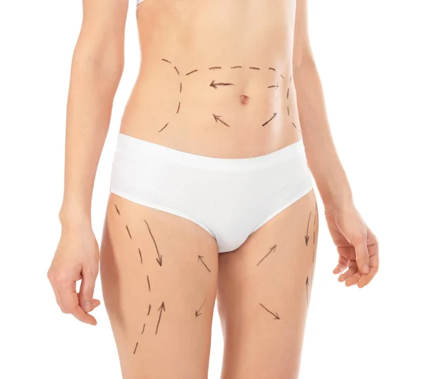 Femme avec des marques sur le corps pour l'opération de chirurgie esthétique sur fond blanc, gros plan — Photo