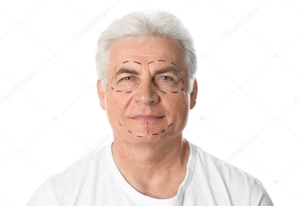 Mature man with marks on face for cosmetic surgery operation against white background