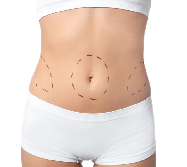 Young woman with marks on body for cosmetic surgery operation against white background, closeup — Stock Photo, Image