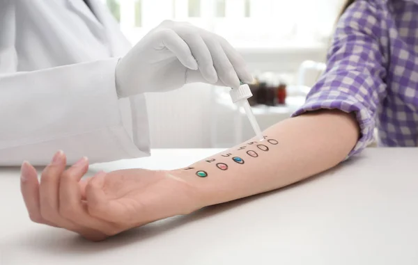 Пацієнт проходить тест на алергію на шкіру за легким столом, крупним планом — стокове фото