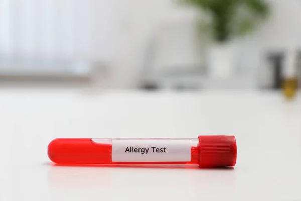 Tube avec étiquette ALLERGY TEST sur table blanche, espace pour le texte — Photo