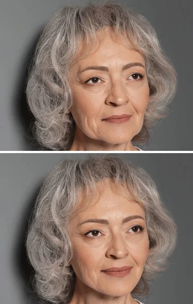 Belle femme mature avant et après la procédure de biorevitalisation sur fond gris — Photo