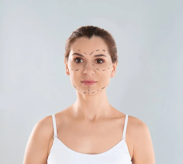 Portrait of woman with marks on face against grey background. Cosmetic surgery — Stock Photo, Image