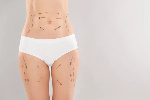 Femme avec des marques sur le corps pour l'opération de chirurgie esthétique sur fond gris, gros plan — Photo