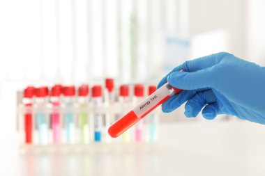 Doktor masa üzerinde etiket Alerji Testi ile tüp tutan, closeup