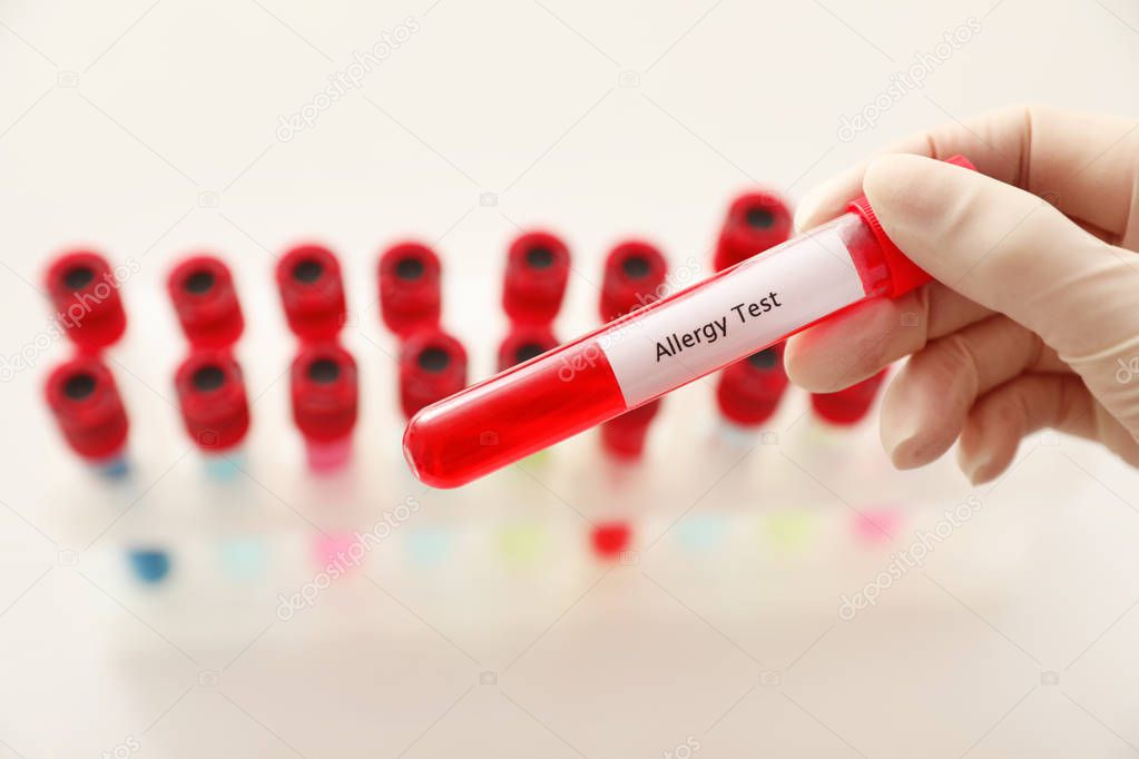Doctor holding tube with label ALLERGY TEST over table, closeup