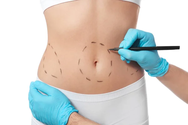 Marcas de desenho médico no corpo da mulher para cirurgia estética operação contra fundo branco, close-up — Fotografia de Stock