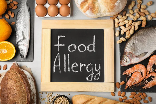 회색 테이블에 단어 음식 알레르기와 식료품 칠판, 평면 평신도 — 스톡 사진