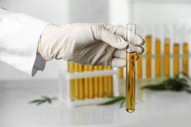 Doktor tablo üzerinde kenevir analizi için idrar örneği ile test tüpü tutan, closeup