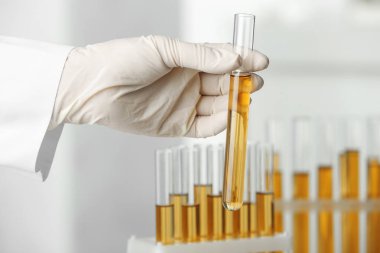 Doktor laboratuvarda kenevir analizi için idrar örneği ile test tüpü tutan, closeup