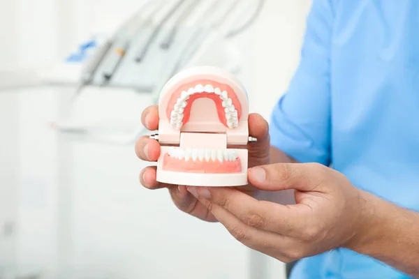 Professional dentist holding jaws model in clinic, closeup