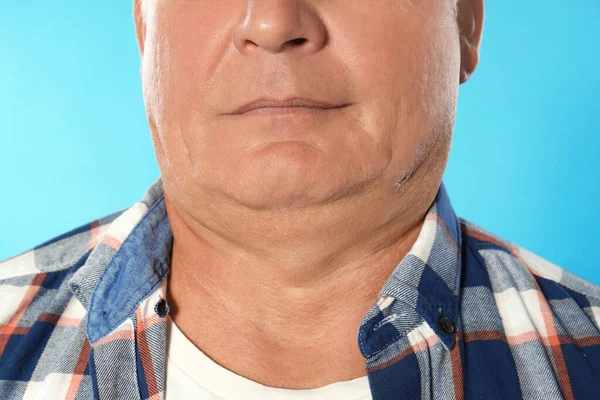 Mature man with double chin on blue background, closeup