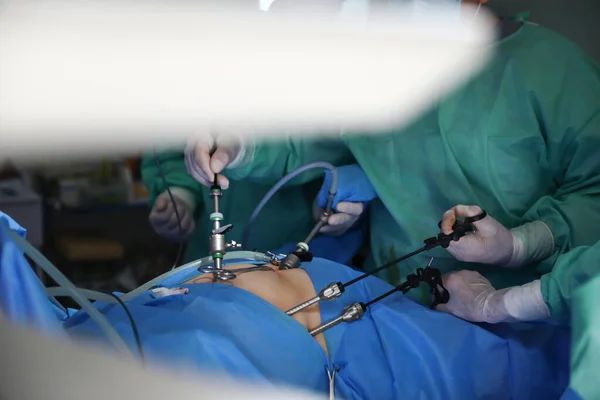 Zespół medyczny wykonujący operacje na sali operacyjnej, zbliżenie — Zdjęcie stockowe