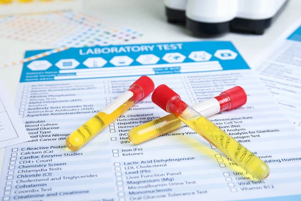 Testbuis met urinemonster voor analyse op laboratoriumtestformulier — Stockfoto