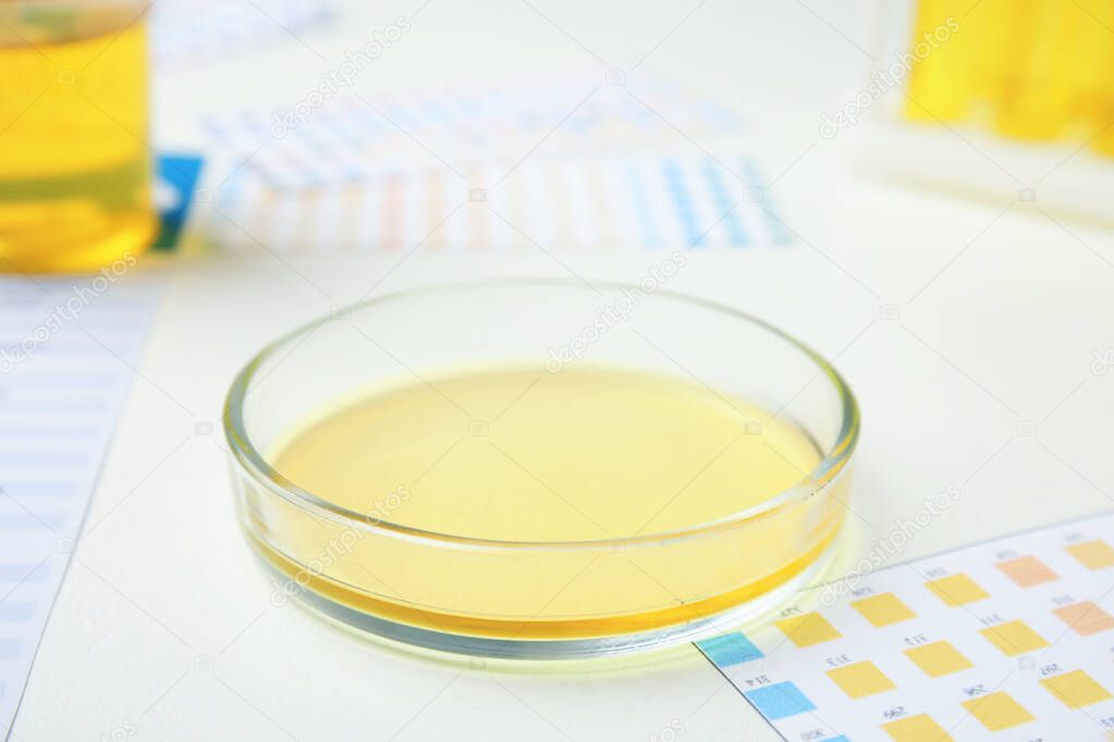 Petri dish with urine sample for analysis on white table