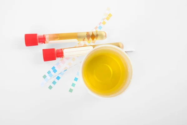 Laboratory ware with urine samples for analysis on white background, top view — Stockfoto