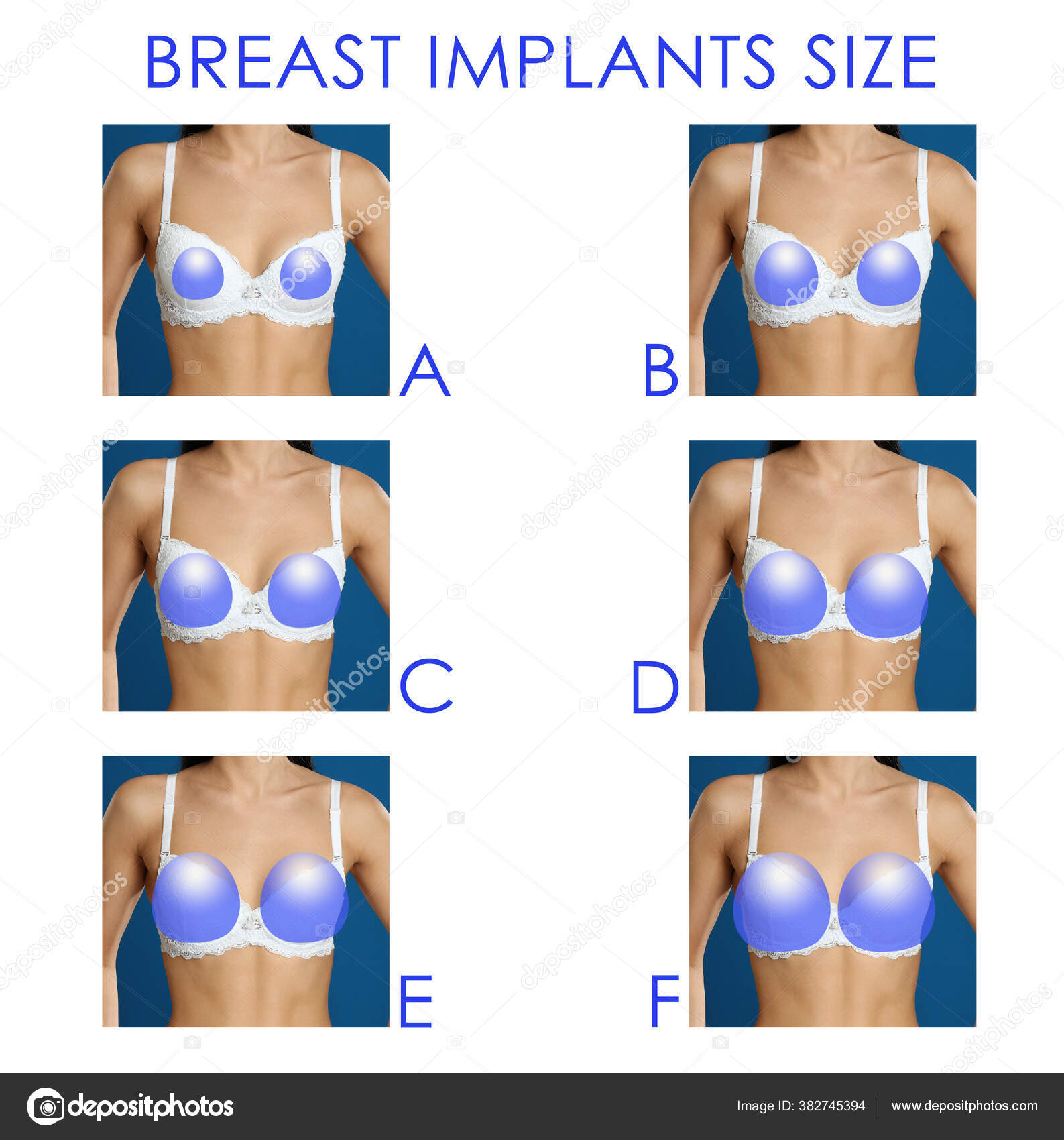 Collage Photos Woman Demonstrating Different Implant Sizes Breast