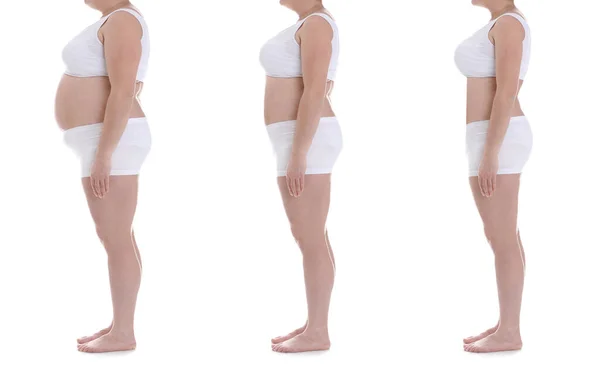 贴有肥胖妇女在白底减肥前后的照片的胶卷 — 图库照片