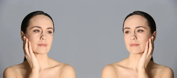 Wanita Dewasa Sebelum Dan Sesudah Prosedur Kosmetik Latar Belakang Abu — Stok Foto