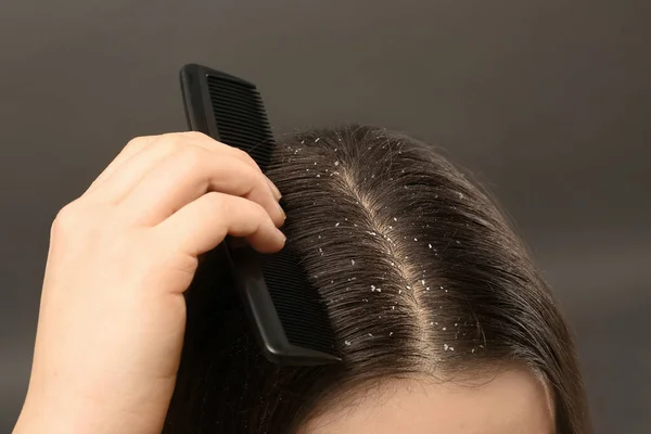 Woman Comb Dandruff Her Dark Hair Grey Background Closeup — Stock Photo, Image