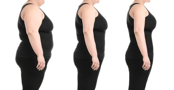 Collage Met Foto Van Overgewicht Vrouw Voor Gewichtsverlies Witte Achtergrond — Stockfoto
