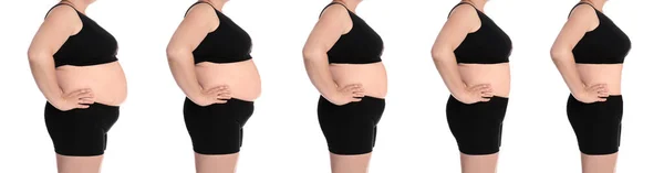 Collage Con Fotos Mujer Con Sobrepeso Antes Después Pérdida Peso — Foto de Stock