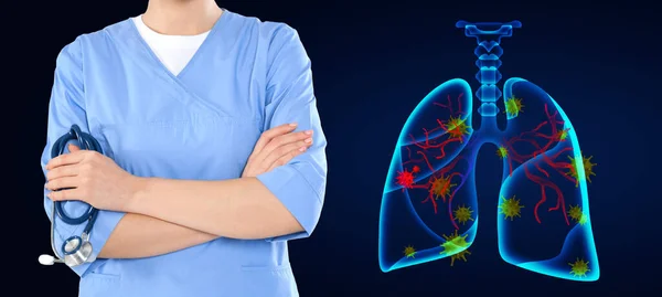 Pulmonologist Lungs Infected Coronavirus Illustration Dark Blue Background Banner Design — Stock Photo, Image
