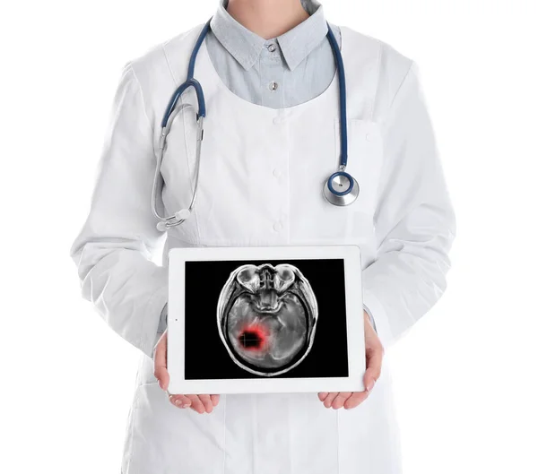 Врач Показывает Рентген Пациента Раком Мозга Таблетке Белом Фоне Крупным — стоковое фото