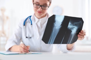 Ofiste radyografiyi inceleyen ortopedist, röntgen fotoğrafına odaklan.