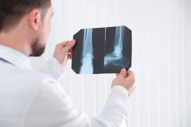 Ofisinde röntgen filmini inceleyen profesyonel ortopedist, ellere odaklan.
