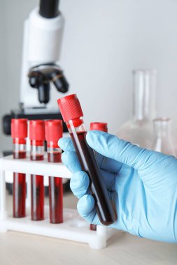 Bilim adamlarının elinde mikroskop yakınında kan örneği olan test tüpü var. Laboratuvar analizi