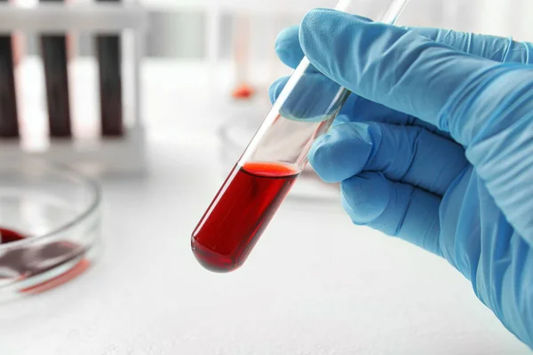 Naukowiec Trzyma Probówkę Próbką Krwi Zbliżenie Analiza Laboratoryjna — Zdjęcie stockowe