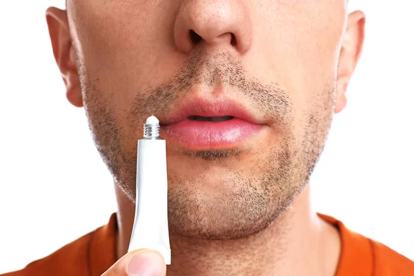 Young man with cold sore applying cream on lips against white background, closeup