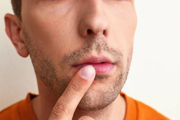 Jongeman Met Koude Zere Toepassing Crème Lippen Tegen Witte Achtergrond — Stockfoto