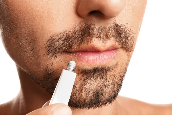 Jongeman Met Koude Zere Toepassing Crème Lippen Tegen Witte Achtergrond — Stockfoto