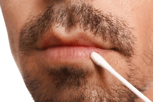 Νεαρός Άνδρας Κρύα Πληγή Εφαρμογή Κρέμα Στα Χείλη Λευκό Φόντο — Φωτογραφία Αρχείου