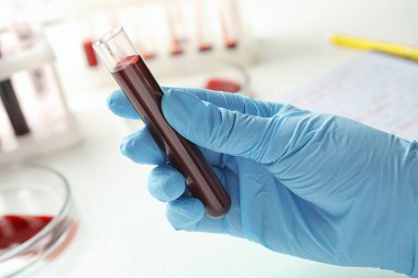 Bilim adamlarının elinde kan örneğiyle birlikte test tüpü var. Yakın plan. Laboratuvar analizi