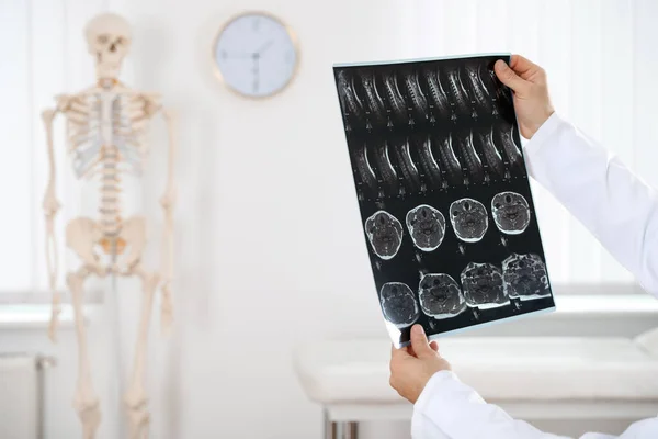 Ортопед Осматривает Рентген Клинике Крупным Планом — стоковое фото