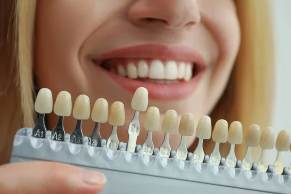 Mujer Que Empareja Color Los Dientes Con Paleta Primer Plano —  Fotos de Stock