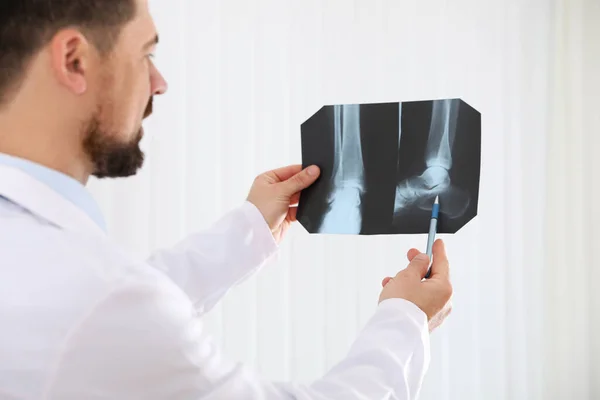 Ortopedista Profissional Examinando Imagem Raios Seu Escritório Foco Mãos — Fotografia de Stock