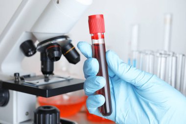 Bilim adamlarının elinde mikroskop yakınında kan örneği olan test tüpü var. Laboratuvar analizi