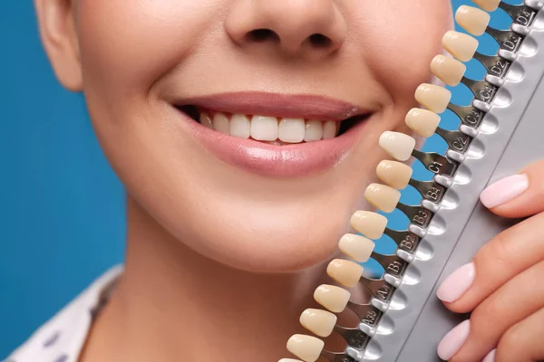 Mulher Verificar Cor Dos Dentes Fundo Azul Perto Odontologia Estética — Fotografia de Stock