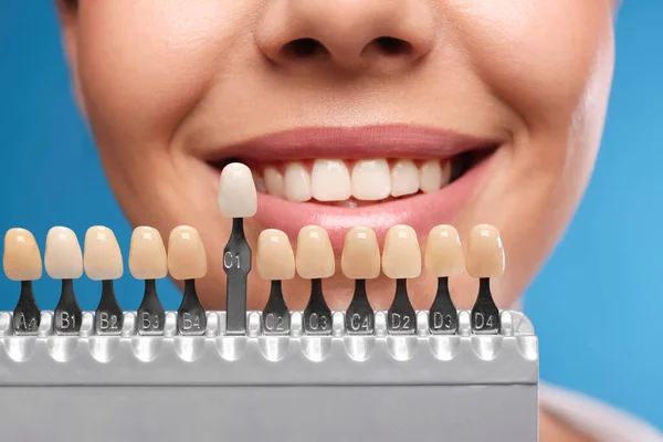 Kvinna Kollar Tänderna Färg Blå Bakgrund Närbild Kosmetisk Tandvård — Stockfoto