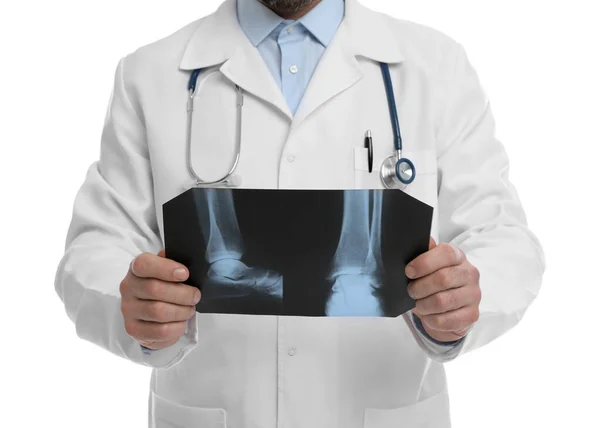 Ortopedista Sosteniendo Imagen Rayos Sobre Fondo Blanco Primer Plano — Foto de Stock