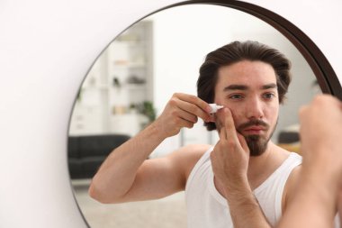 Evinde aynanın yanında yüzüne krem sürmekte zorlanan genç bir adam.